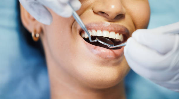 Best Emergency Dental Extractions in Giddings, TX