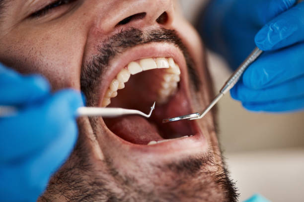 Best Mobile Emergency Dentist in Giddings, TX