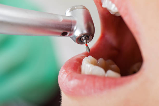 Best Urgent Dental Care for Toothache in Giddings, TX